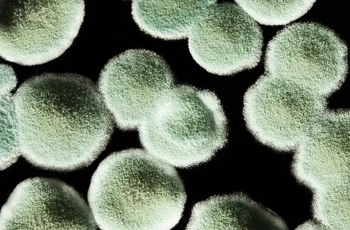 Macro photography of grayish green mold spores.